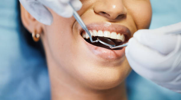 Best Broken or Cracked Tooth Emergency Dentist in La Mesa, CA